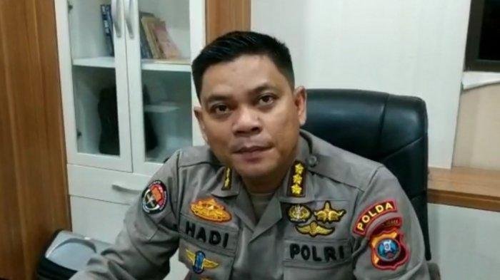 Kepala Bidang Humas Polda Sumatera Utara Kombes Hadi Wahyudi.