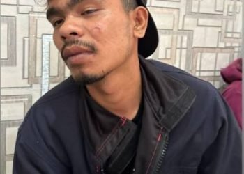 Korban pengeroyokan rombongan Paslon Bupati menunjukkan luka di bagian wajah.