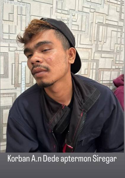 Korban pengeroyokan rombongan Paslon Bupati menunjukkan luka di bagian wajah.