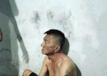 Pria bernama Alang (58) meninggal dunia setelah mendapat perawatan di RS Bhayangkara Medan.